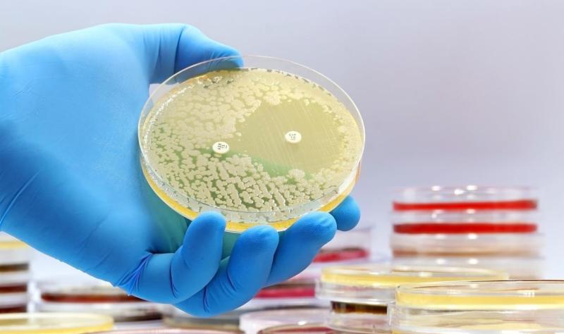 Resistant bacteria in petri dish