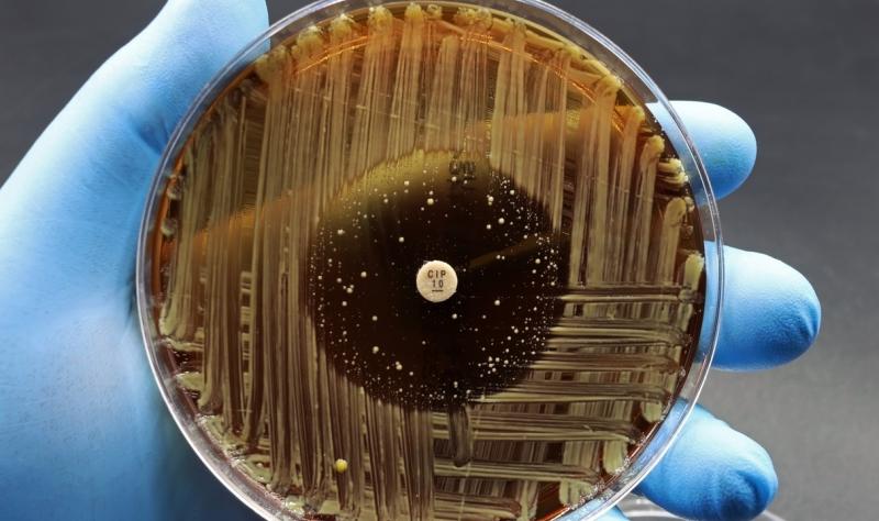 Resistant bacteria in petri dish
