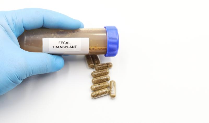 FMT capsules