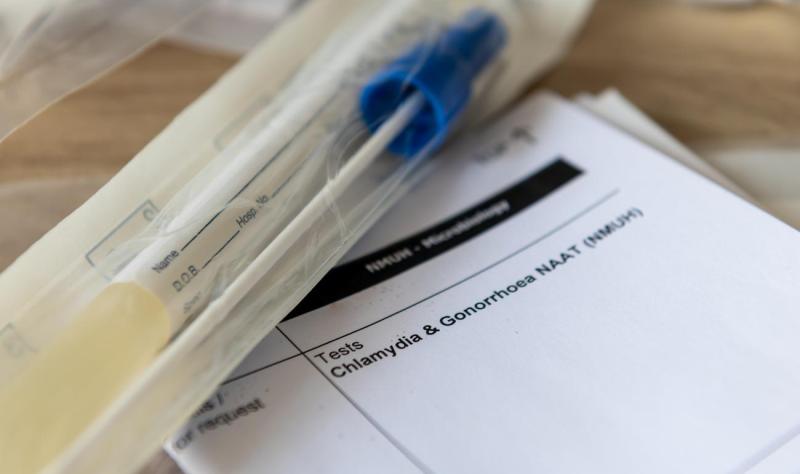 Real-world studies boost case for doxyPEP to prevent sexually transmitted diseases