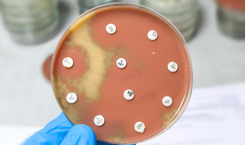 Antibiotic resistant bacteria in petri dish