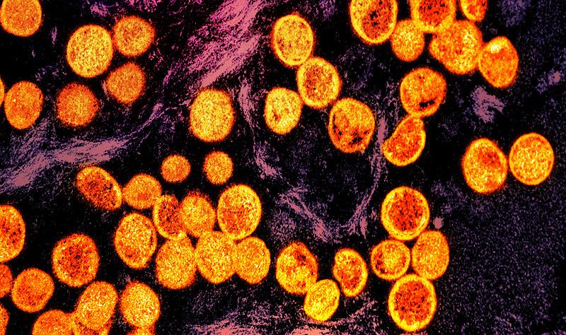 Kenya and Zambia battle mpox spikes as African countries manage multiple health threats