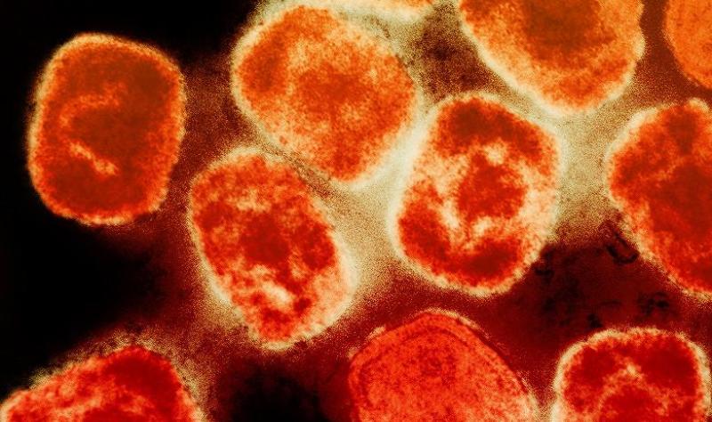 UK health officials warn of new mpox variant