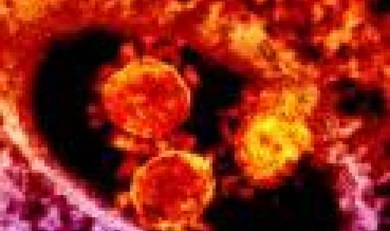 Saudi Arabia Announces Three New Mers Cases Cidrap Saudi Arabia Announces Three New Mers Cases Cidrap