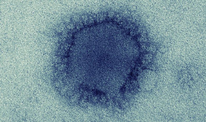 Study Suggests Multiple Mers Cov Introductions Cidrap Study Suggests Multiple Mers Cov Introductions Cidrap