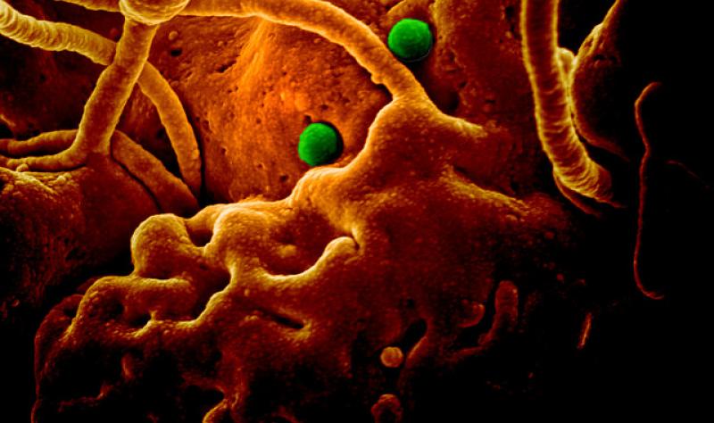 Who Panel Mers Still Not An International Emergency Cidrap Who Panel Mers Still Not An International Emergency Cidrap