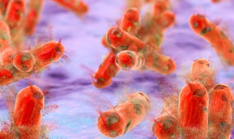 Highly drug-resistant TB spreading person to person: study | CIDRAP