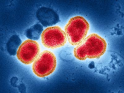 flu strain