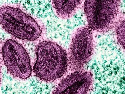 mpox virus