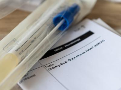 STI testing
