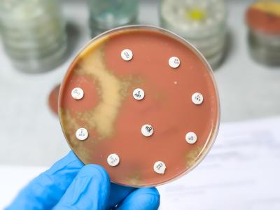 Antibiotic resistant bacteria in petri dish