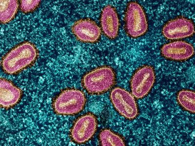 mpox blue purple