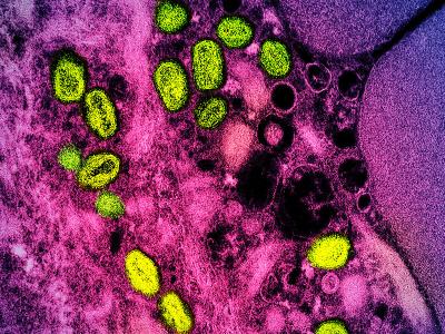 mpox green purple
