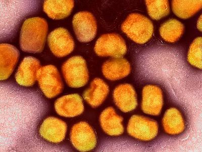 mpox purple orange