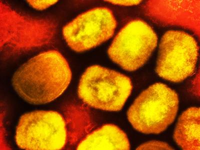 mpox red gold