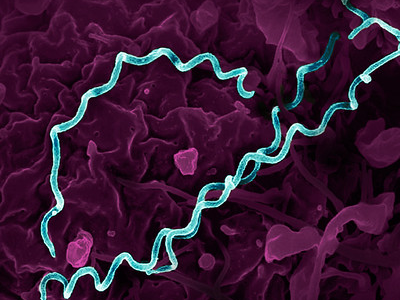 Syphilis bacteria