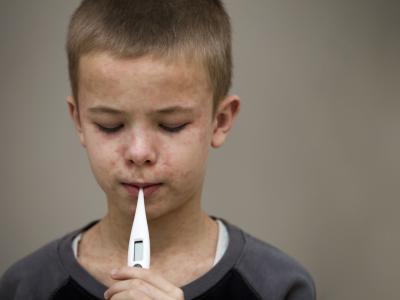 young boy measles fever