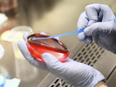 Blood culture testing