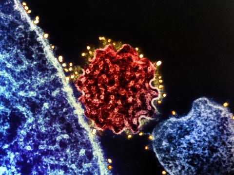 nipah virus particles