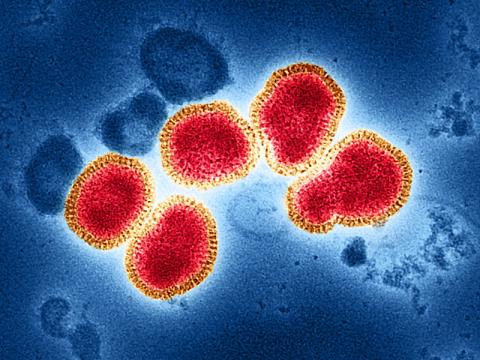 flu strain