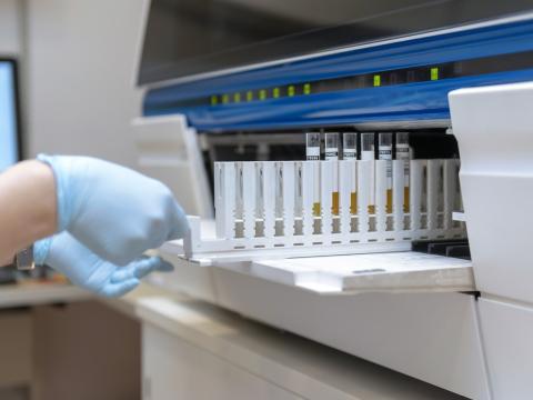 Analyzing urine samples