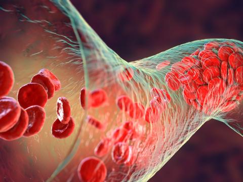 Blood clot and platelets