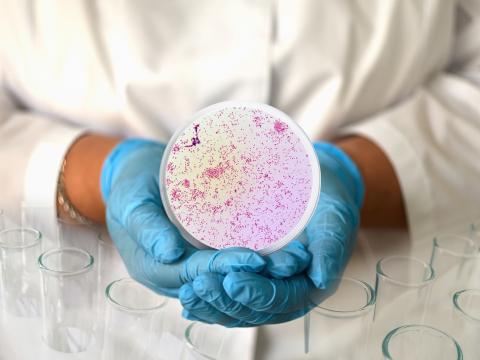 Gonorrhea bacterial culture