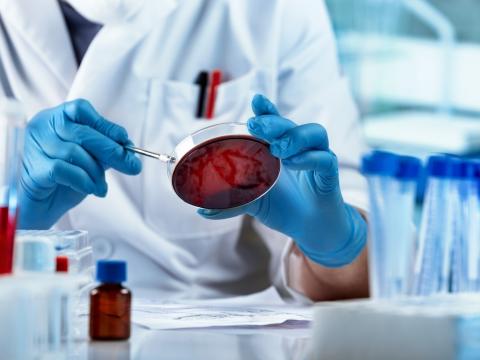 Lab worker with petri dish