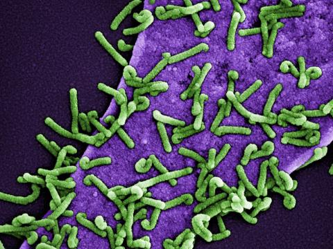 Marburg virus particles