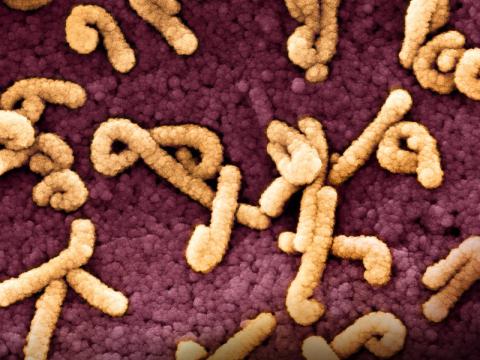 Marburg virus particles