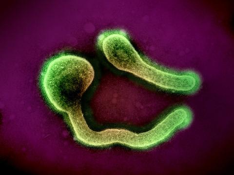 Marburg virus particles