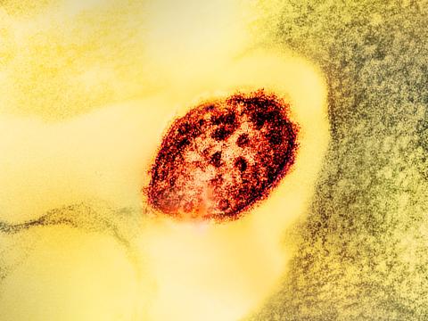 Measles virus