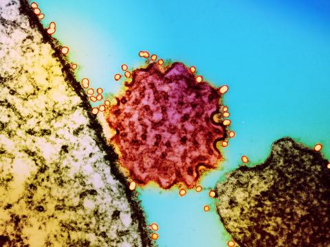 Nipah virus particles