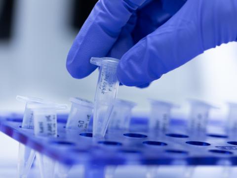 PCR testing