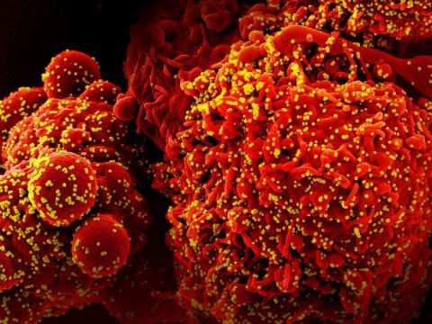 covid virus