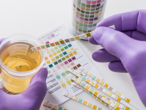 Urinalysis