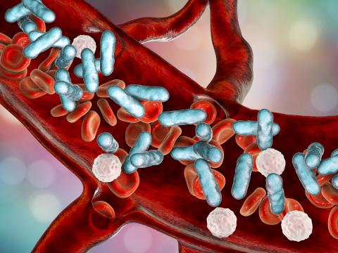 Sepsis illustration