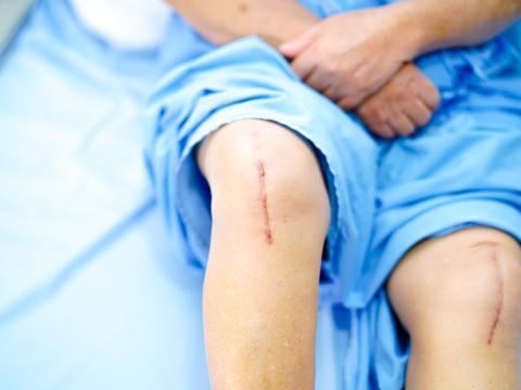 Patient after knee replacement surgery