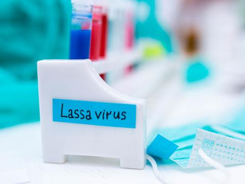 lassa test 