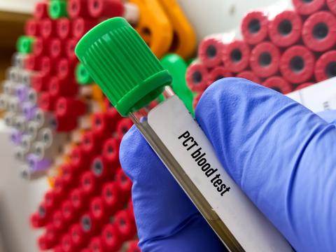 Procalcitonin blood test