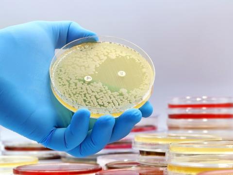 Antibiotic susceptibility test