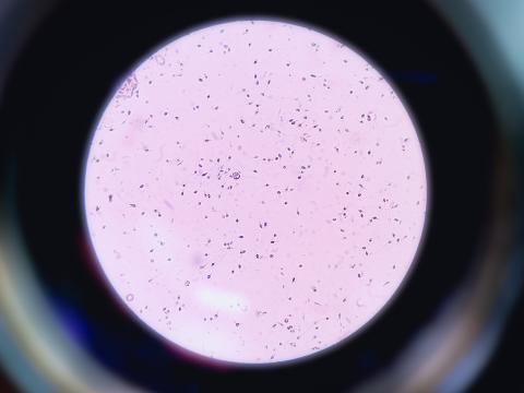 sperm 