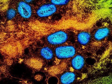 mpox virus particles