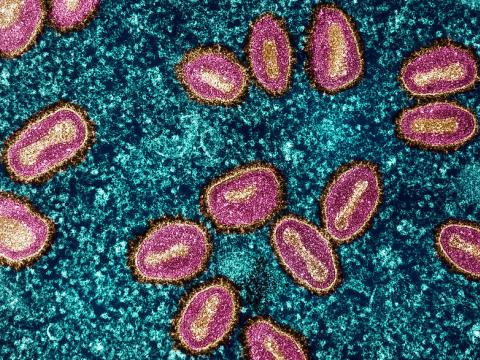 mpox blue purple