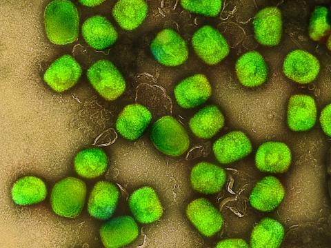mpox virus green