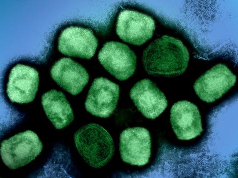mpox virus