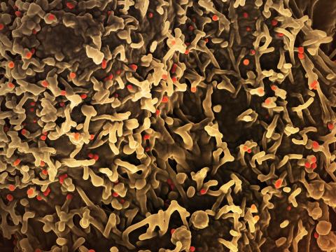 mpox virus 