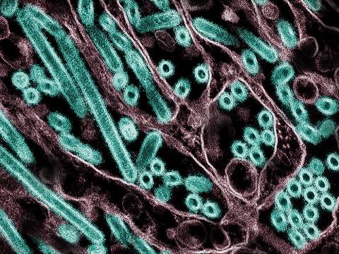H5N1 particles