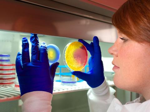 Plates inoculated with methicillin-resistant Staphylococcus aureus (MRSA) bacteria.