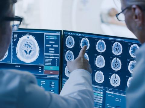Doctors assessing brain scans